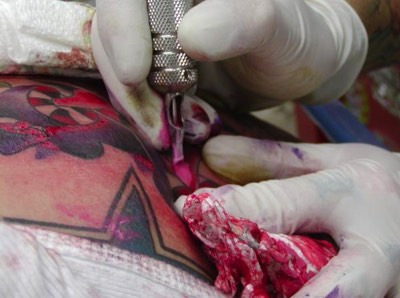  Applying color to a tattoo 